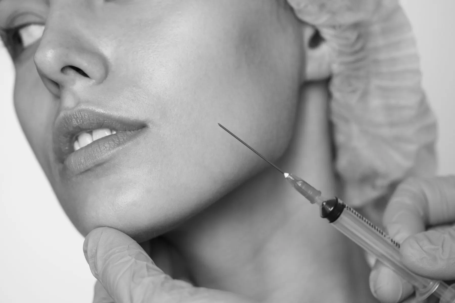 Black and white close-up of a fine needle placed along the jawline by a gloved injector