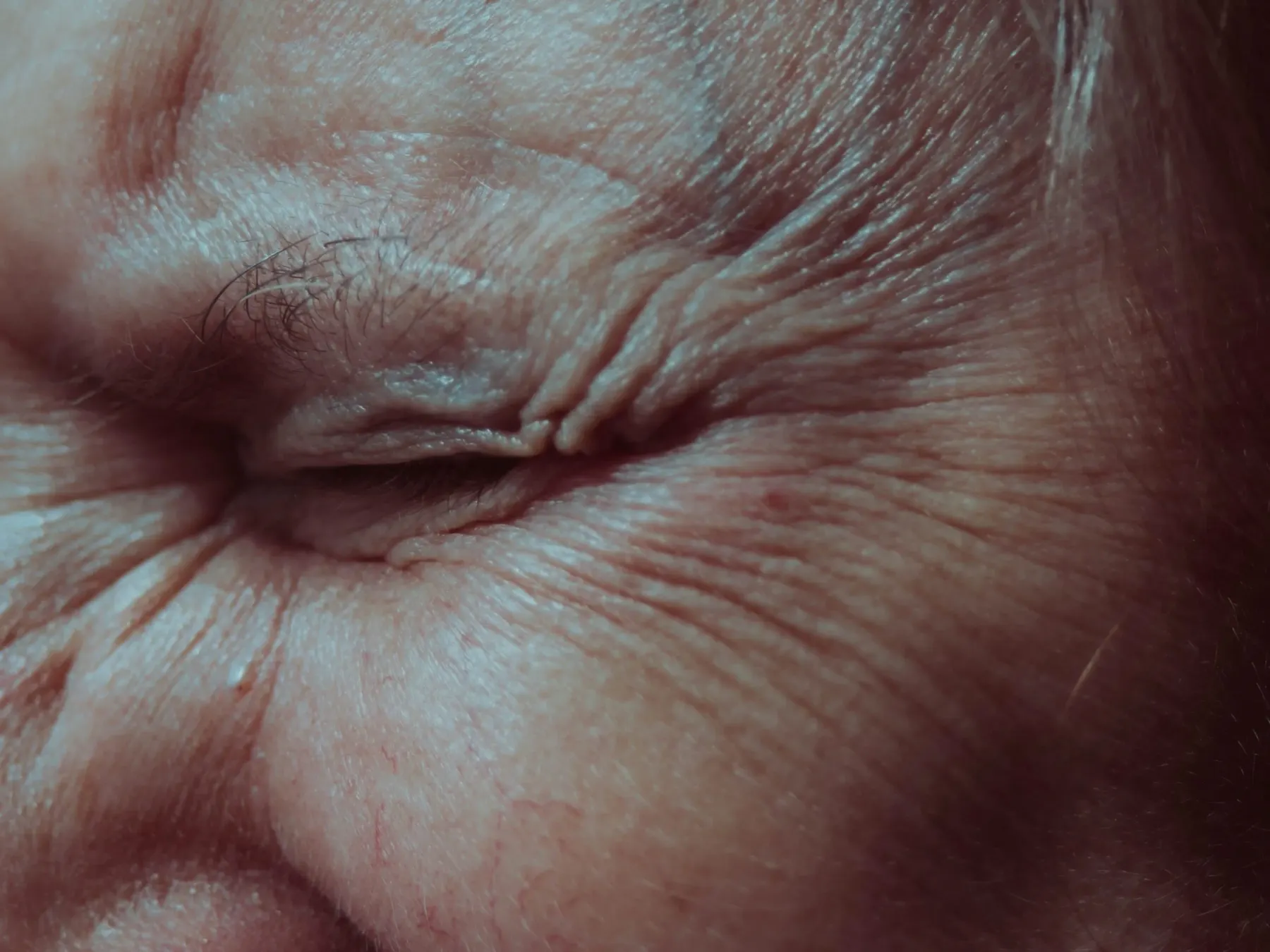 Very close crop of deeply creased skin around a closed eye