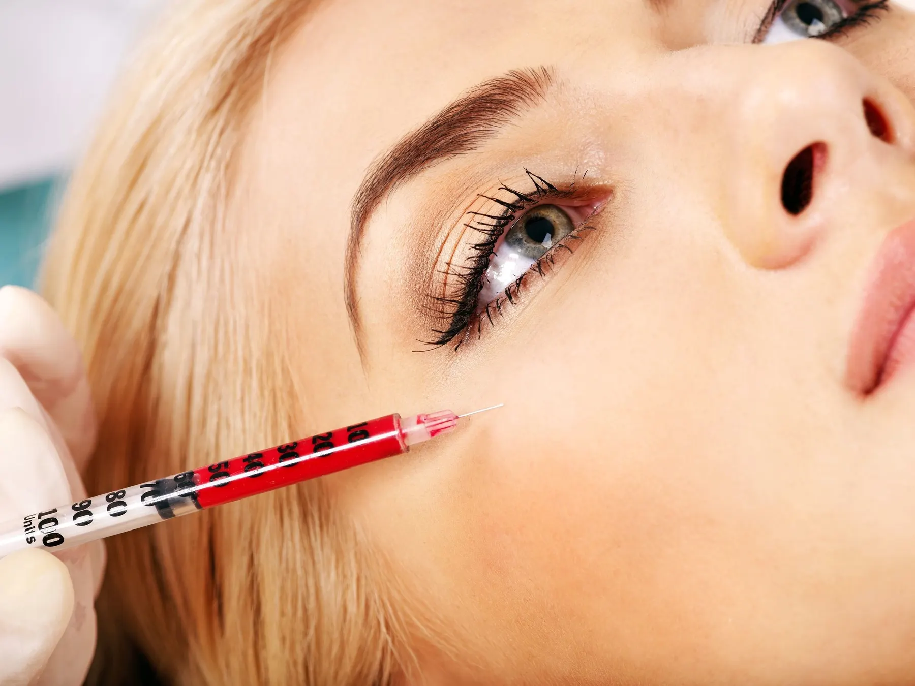 Close-up of a fine needle placed at the outer corner of a client eye by a gloved injector