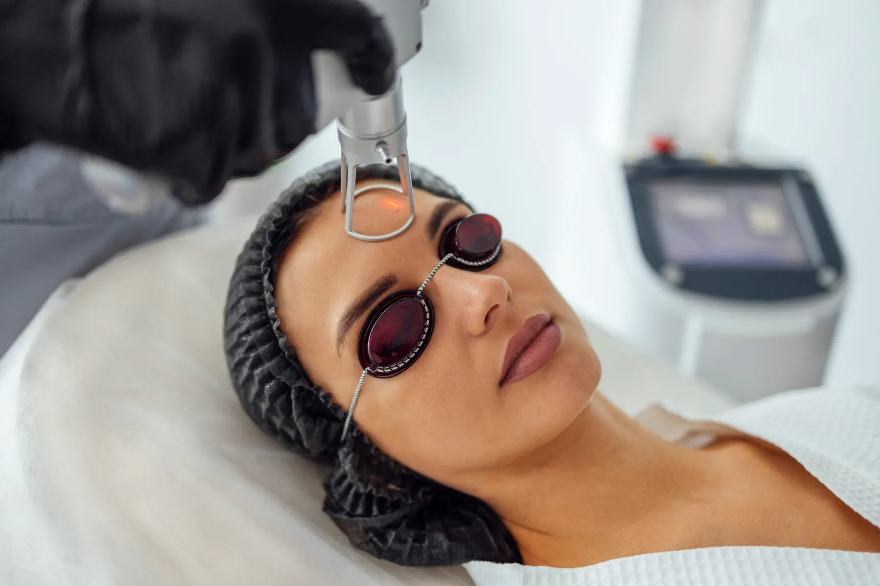 A close-up of a client in a surgical cap and metal laser eye shields with a treatment handpiece held above her cheek.