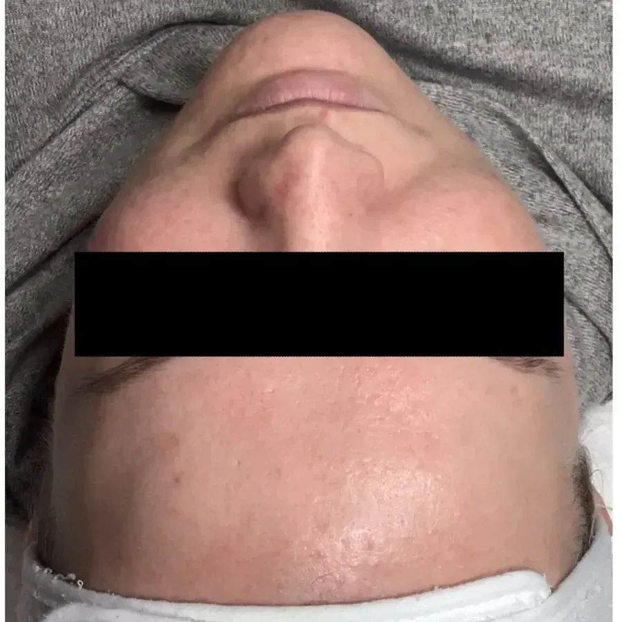 A real client result
