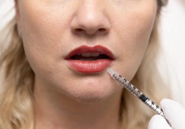 Dermal Fillers