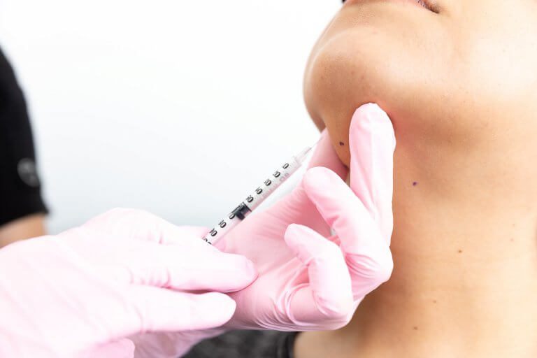 Belkyra Treatment