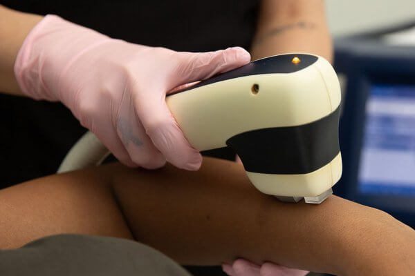 Laser Hair Removal Treatment