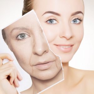 Retinol