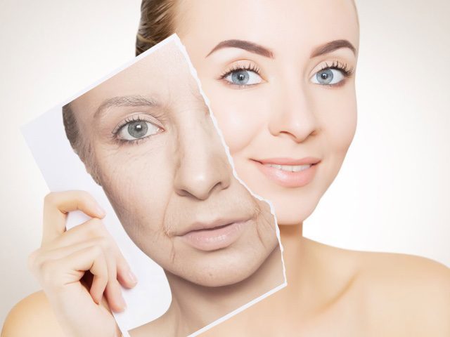 Skin Laxity