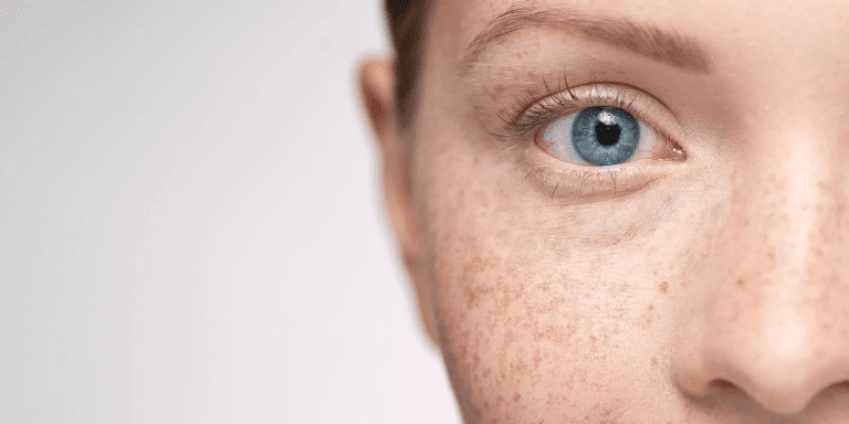 Pigmentation