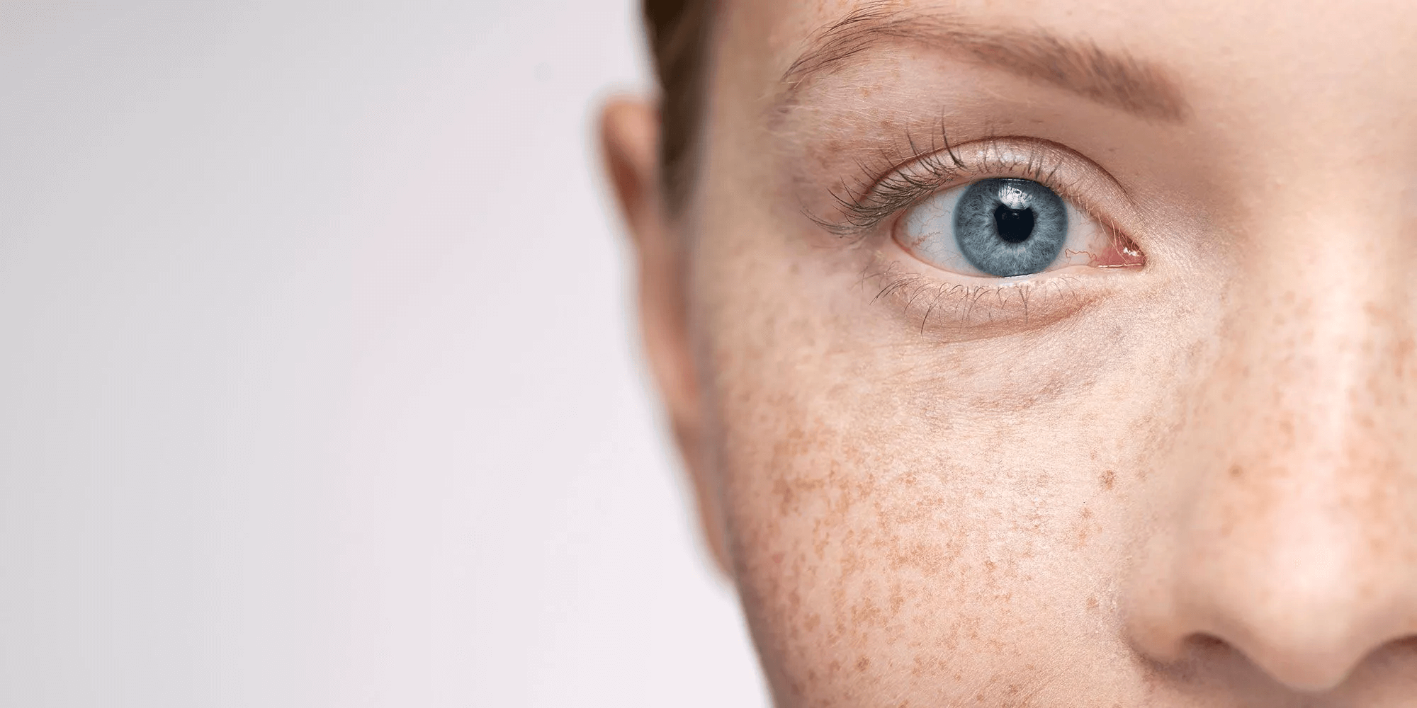 Pigmentation